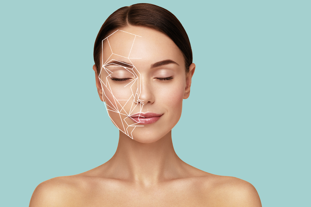 Facial mapping showing application directions for dermal fillers.